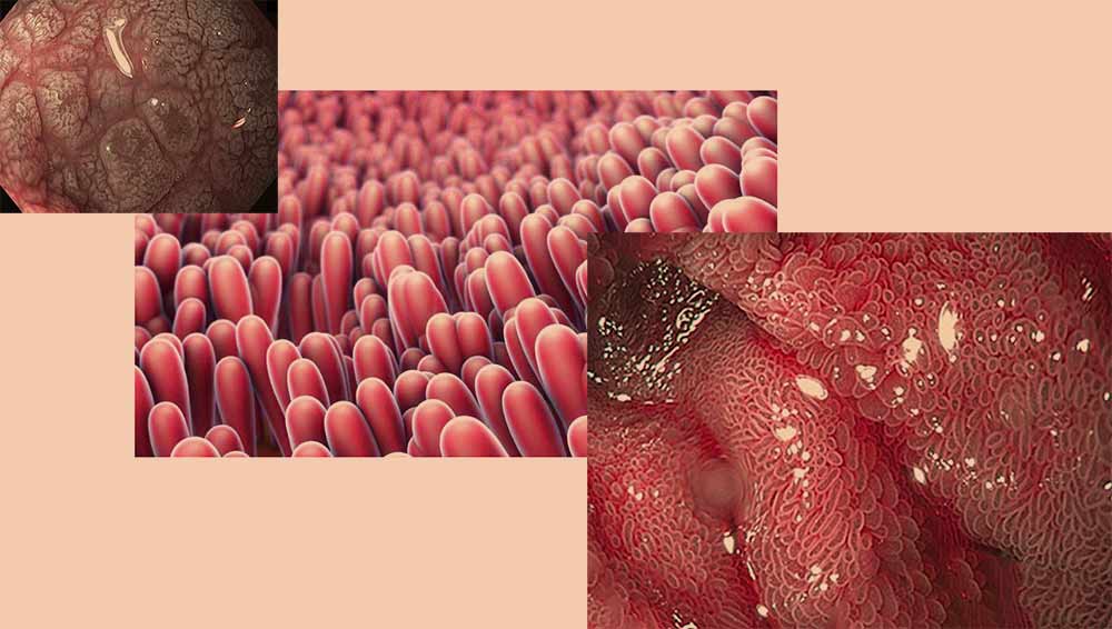 <a href='/glutencheck-hitri-test-za-dolocanje-celiakije-1-test'>celiakija</a>-lekarna